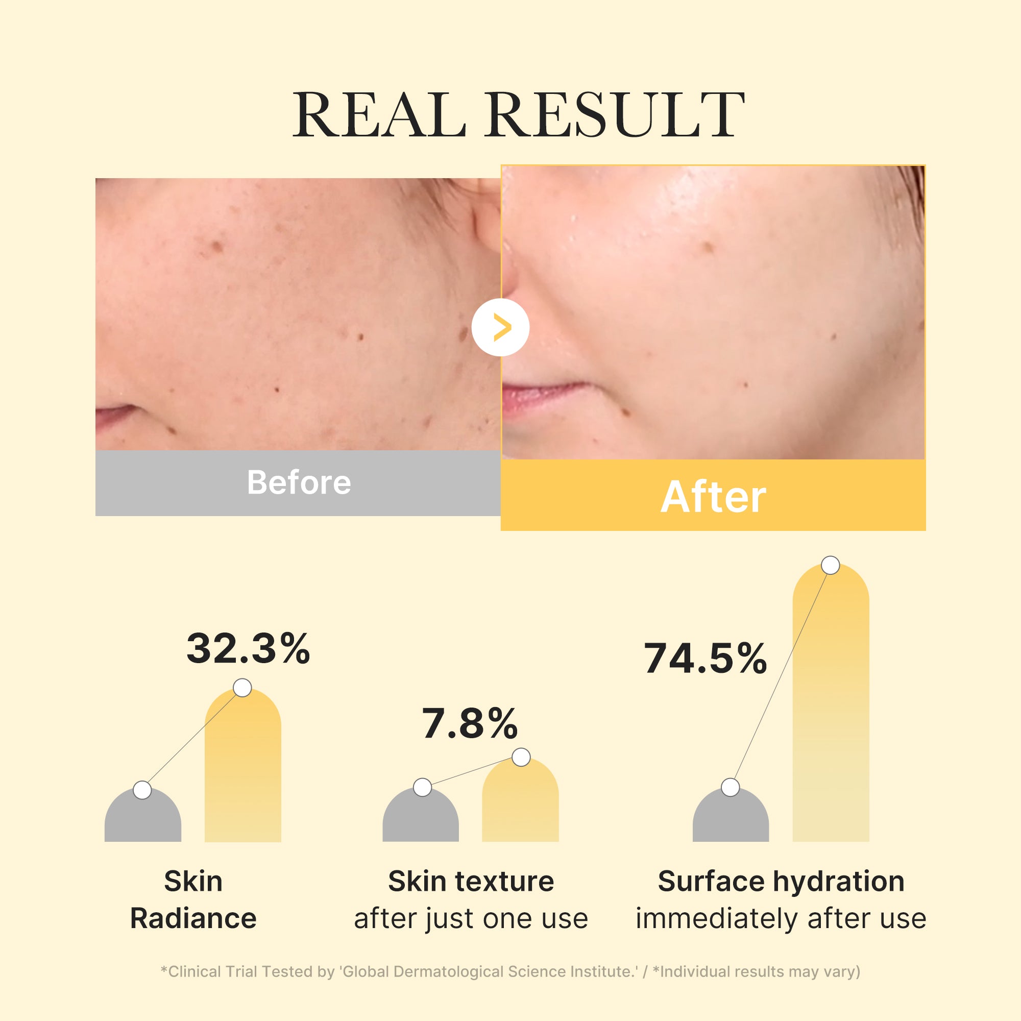 OFFERT Masque Gelée Or Curcuma & Kojic — Teint Éclatant & Unifié