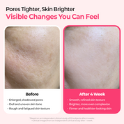 Lumi Pore & Spot Care Duo