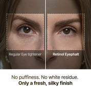 Retinol Eyebag Cream