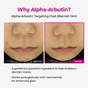 Picotonic Shot Pigmentation Ampoule