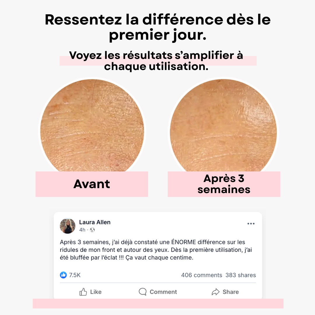 Routine Triple Collagène 5en1