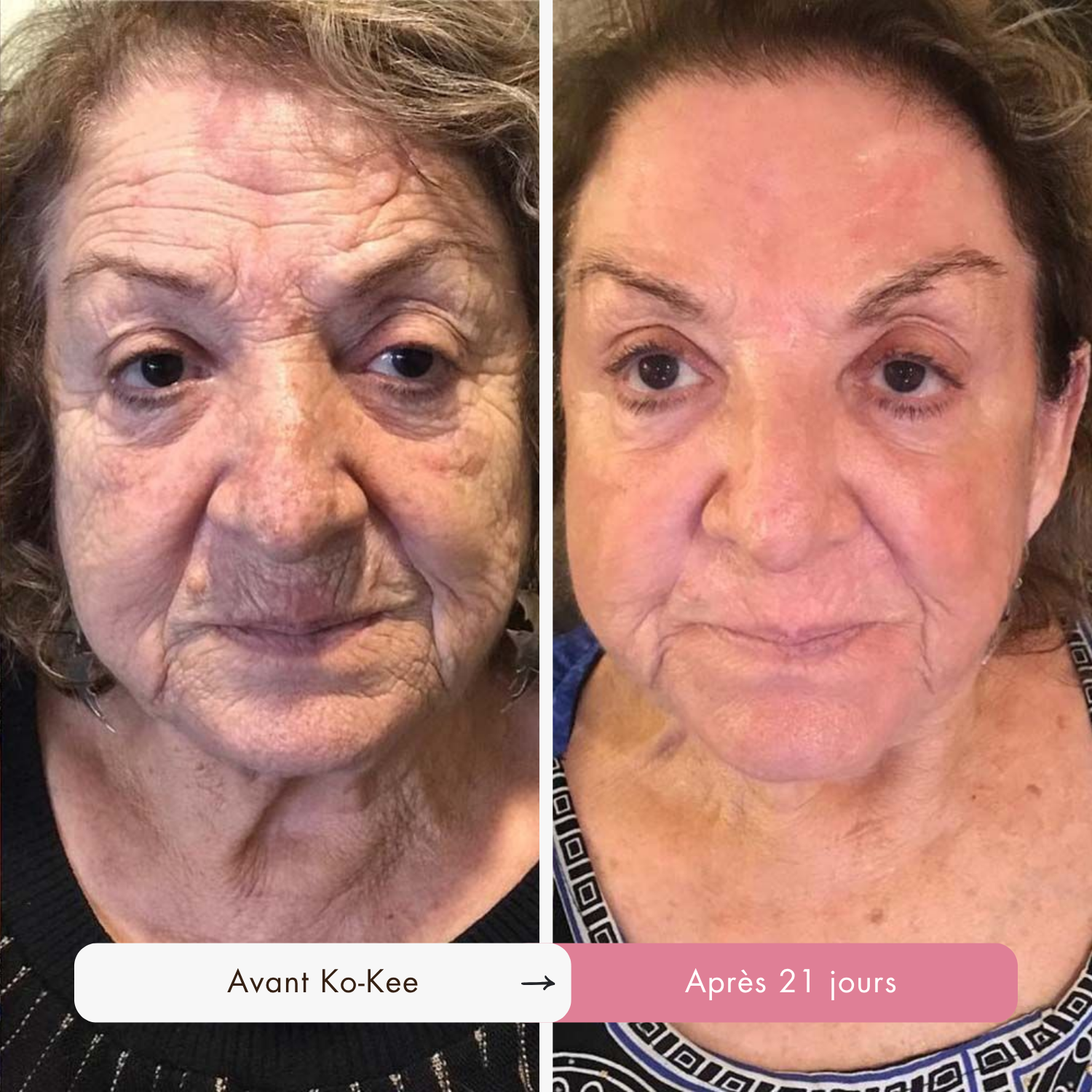 Routine Triple Collagène : L'Effet Lifting Garanti en 7 Jours