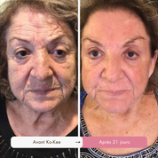 Routine Triple Collagène : L'Effet Lifting Garanti en 7 Jours