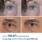 Crème Contour Yeux Eyephalt Adieu Cernes Et Poches