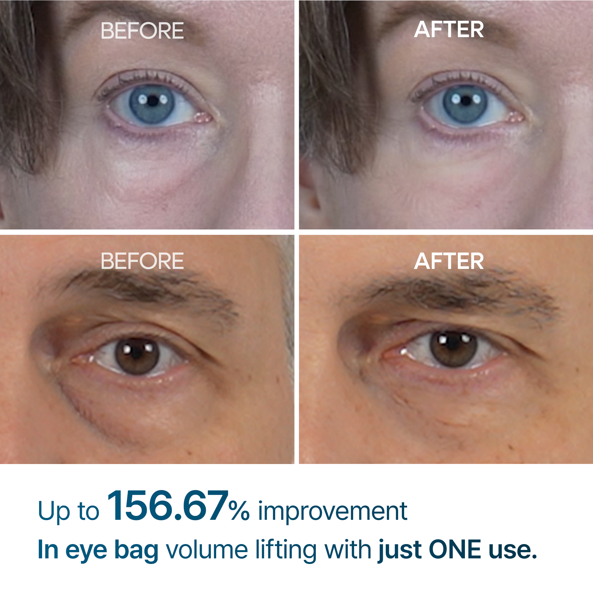 Crème Contour Yeux Eyephalt Adieu Cernes Et Poches