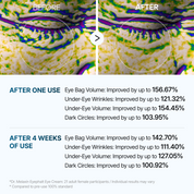 Crème Contour Yeux Eyephalt Adieu Cernes Et Poches