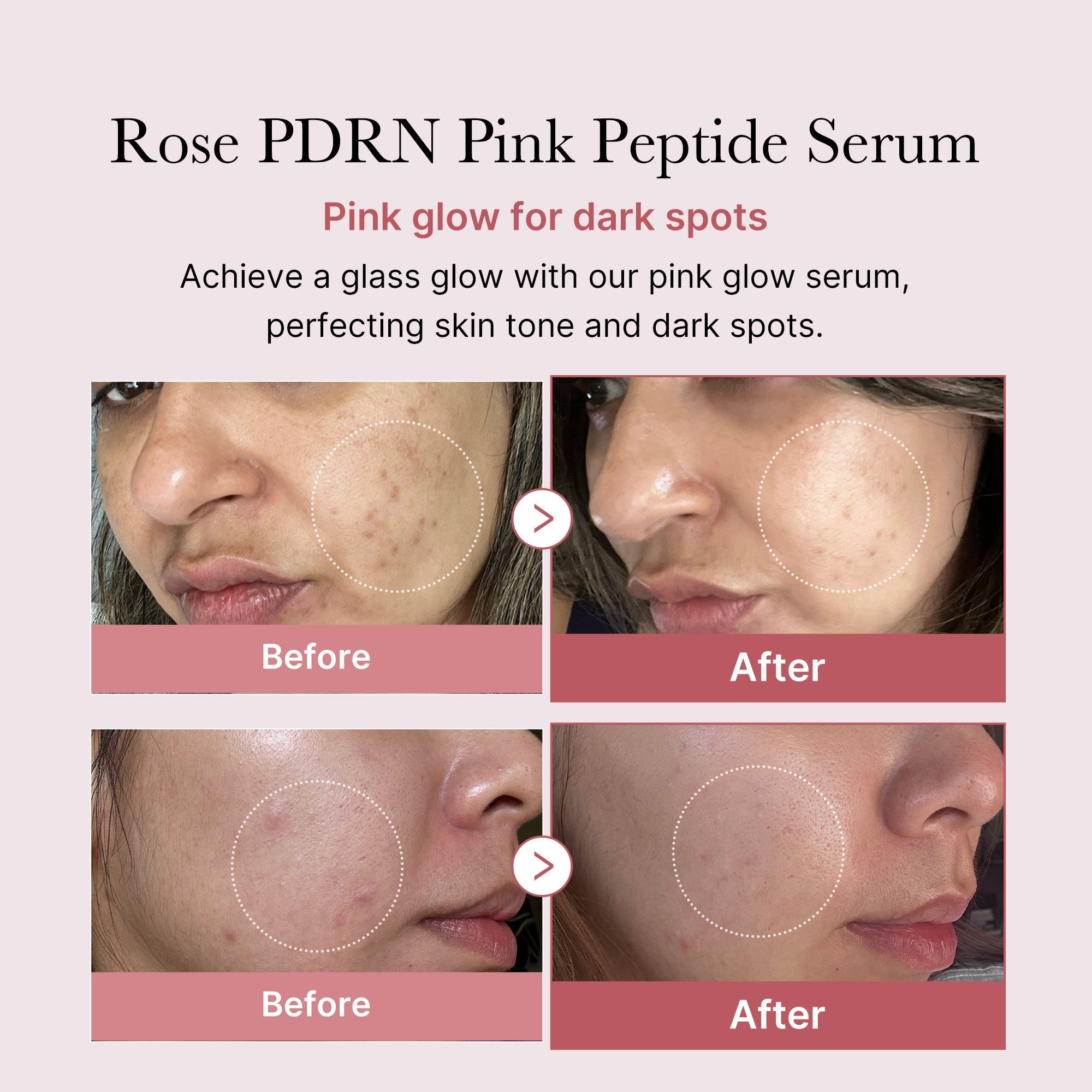 PDRN Pink Peptide Serum Repulpe & Unifie la Peau