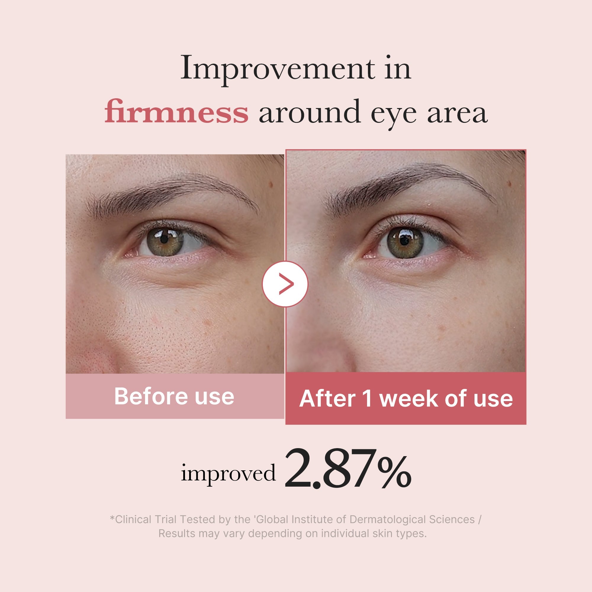 Crème Yeux PDRN Pink Peptide Anti Rides Et Anti Cernes