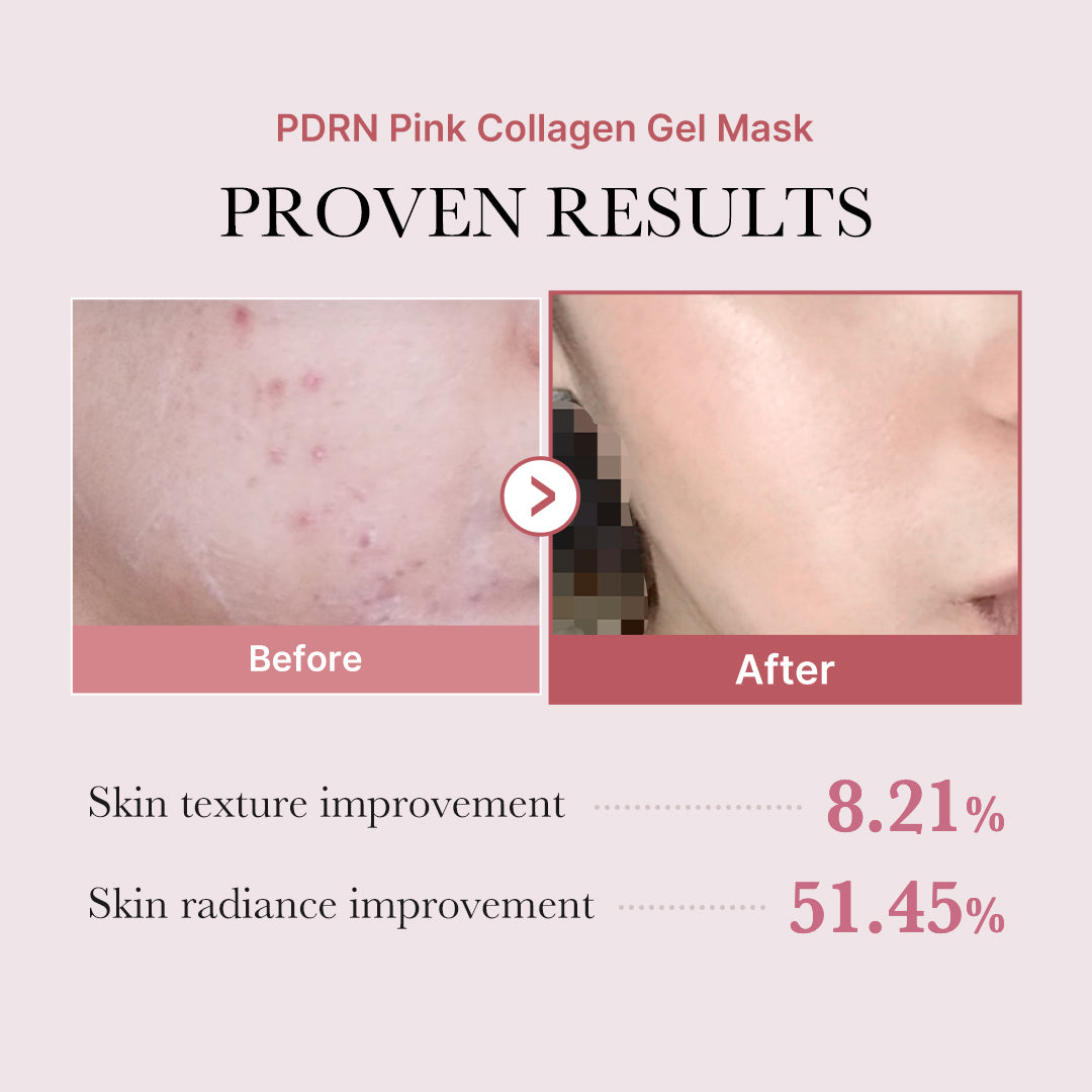Masque Gelée Rose au Collagène & PDRN — Réparation & Glow Instantané