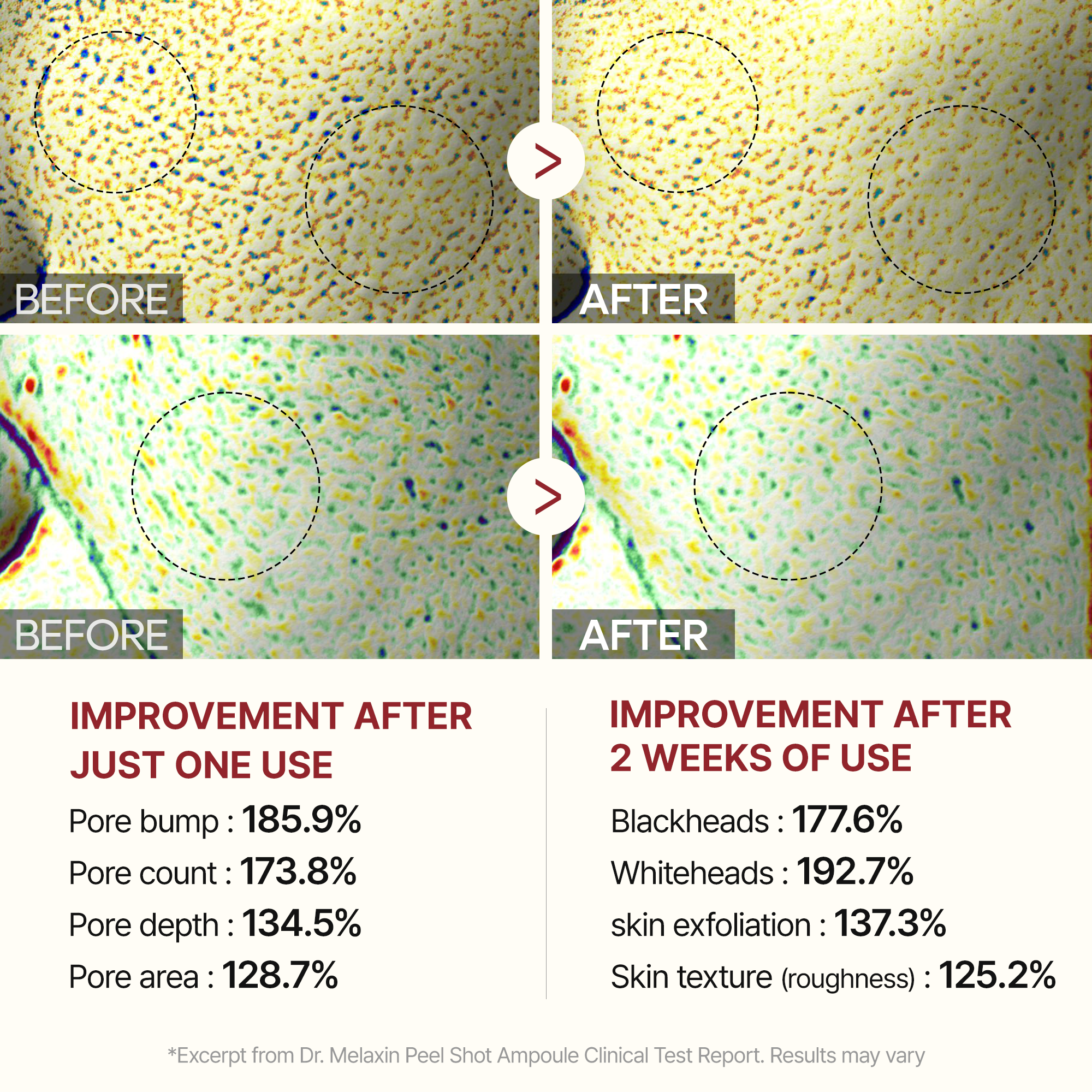 Peel Shot Glow White Rice Ampoule Élimine Peaux Mortes Et Illumine 30 Secondes