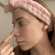 Peel Shot Glow Black Rice Ampoule