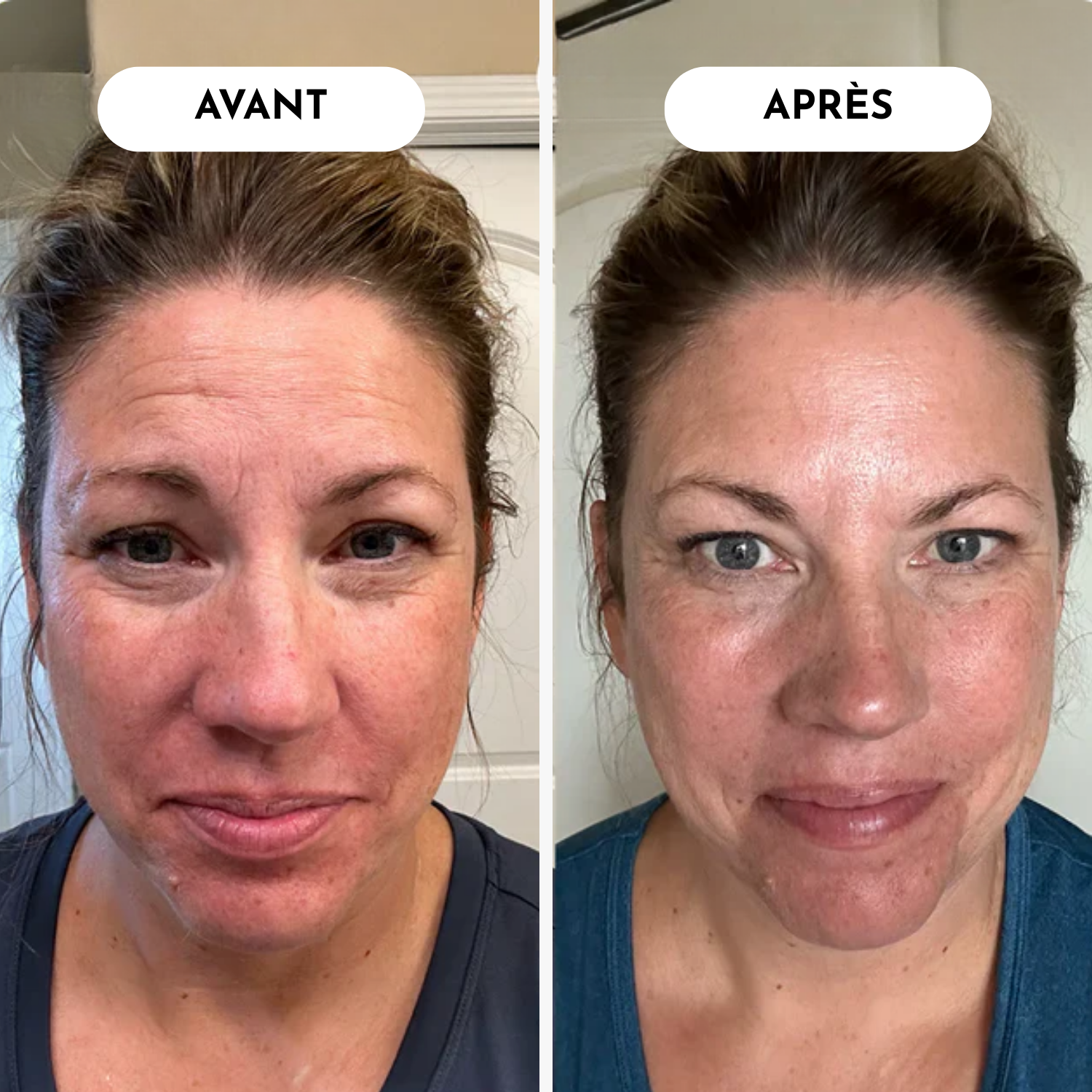 Routine Triple Collagène Anti-Âge