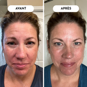 Routine Triple Collagène Anti-Âge
