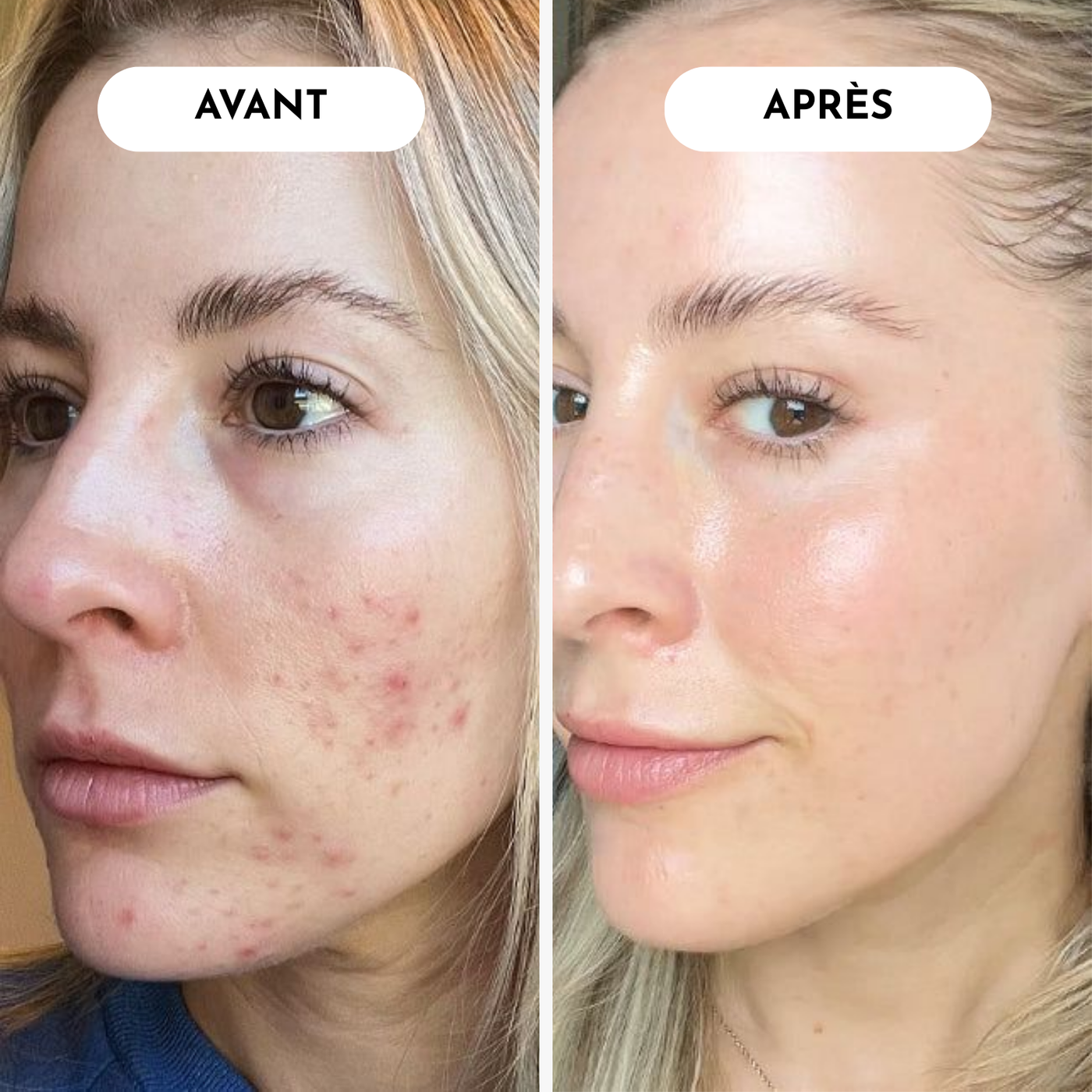 Claire, 36 ans