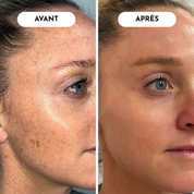 Peel Shot Glow White Rice Ampoule Élimine Peaux Mortes Et Illumine 30 Secondes