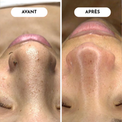 Zero Pore Pads Pores Resserrés Et Grain Affiné